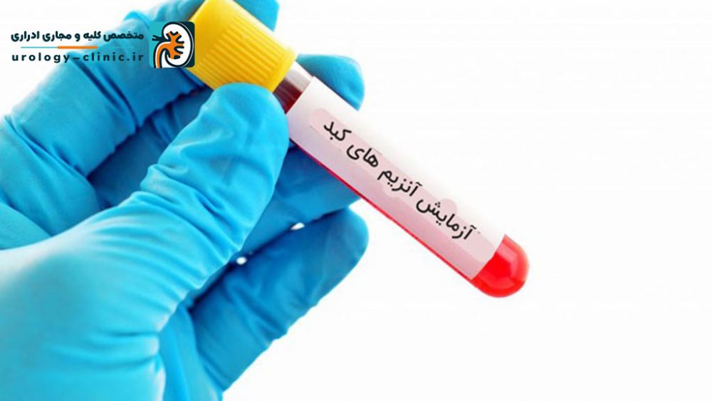 افزایش آنزیم کبد