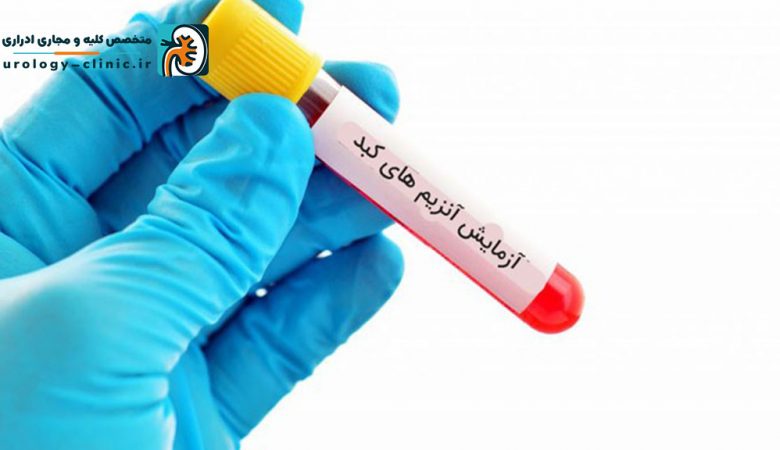 افزایش آنزیم کبد